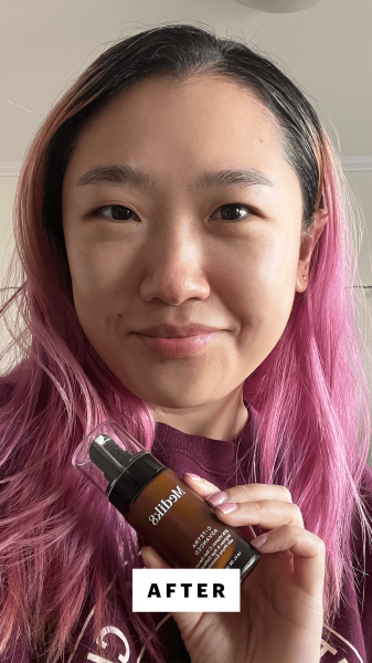 Han after applying the Medik8 CTetra Advanced GelSerum